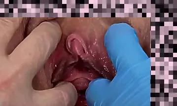 mature gyno exam