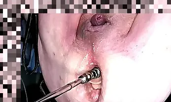 chubby mature anal